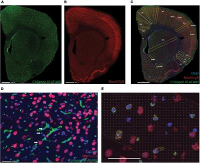 Resting Rates of Blood Flow and Glucose Use per Neuron Are Proportional to Number of Endothelial Cells Available per Neuron Across Sites in the Rat Brain